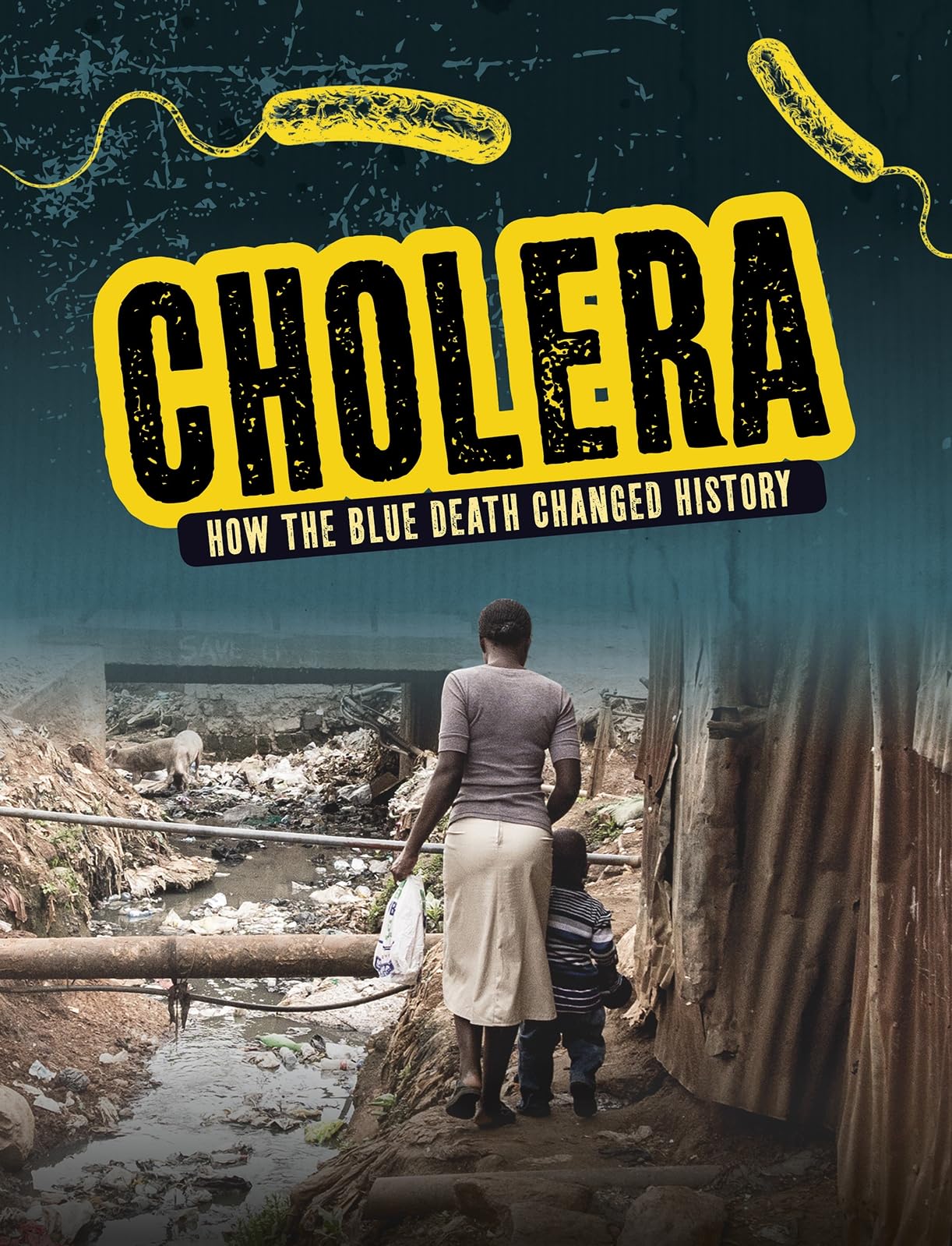 Cholera by Mark K. Lewis