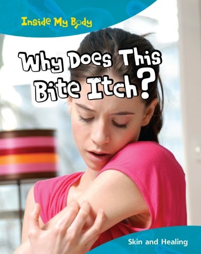 Why Does This Bite Itch? (Inside My Body) by Steve Parker