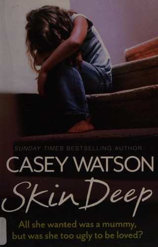 Skin Deep: All she wanted was a mummy, but was she too ugly to be loved? by Casey Watson