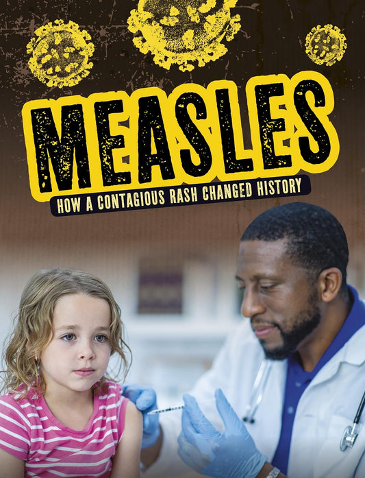 Measles by Mark K. Lewis