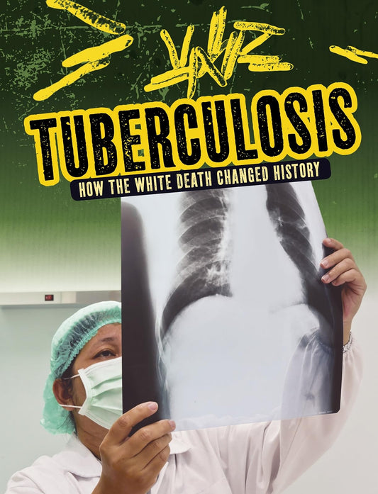 Tuberculosis by Mark K. Lewis
